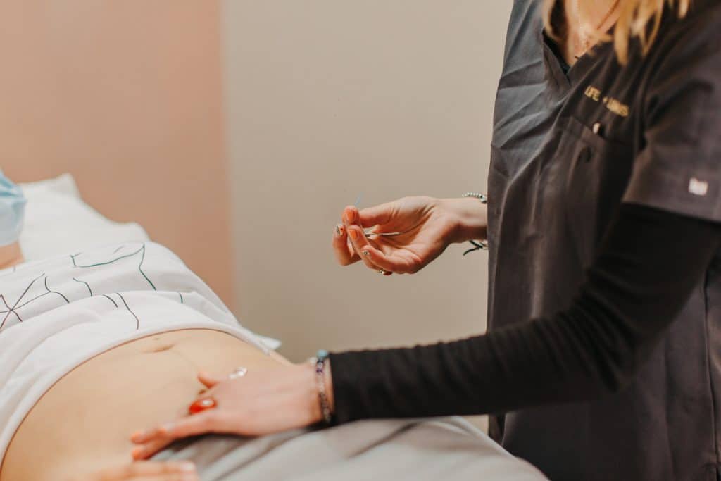 Fertility Acupuncture in Sheffield
