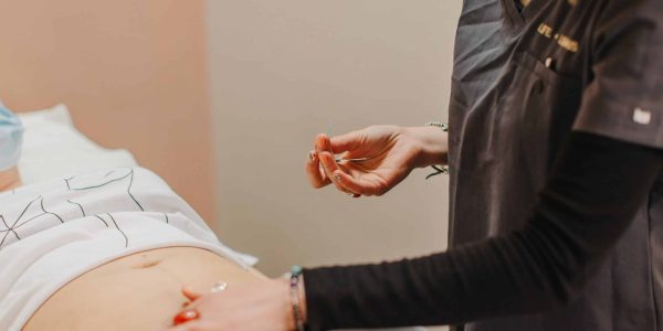 Fertility Acupuncture in Sheffield